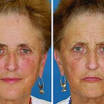 twins_aging_0204